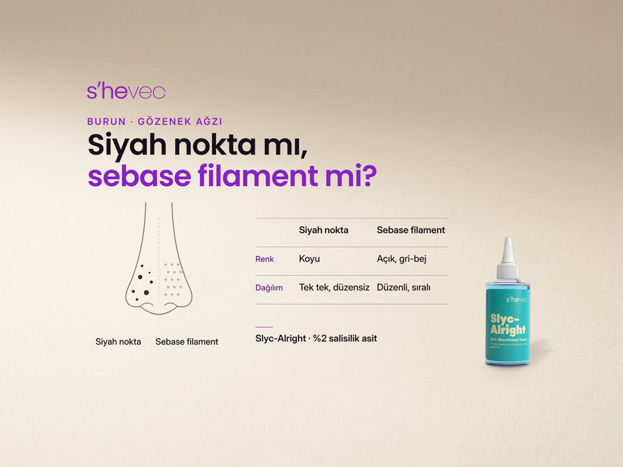 Siyah nokta mı, sebase filament mi? — Siyah Nokta Görünümü Neden Olur, Nasıl Azaltılır?